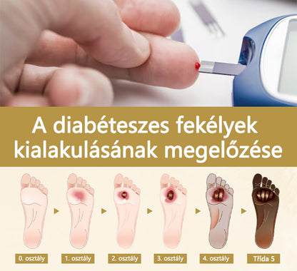 Timilk® Diabetikus lábgyógyító spray - Méhméreggel átitatott
