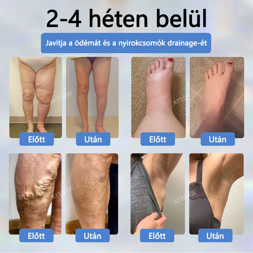 Cvreoz® Fekete kömény Ödéma méregtelenítő gyógynövénykrém🌿