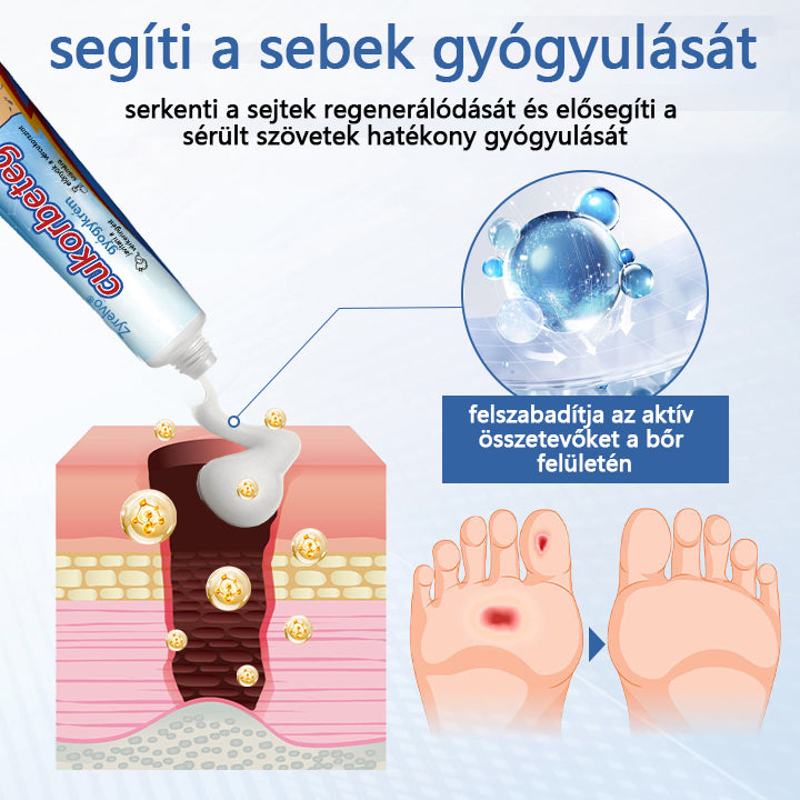 Zyrelvo®🎉VitaGluco cukorbetegség kezelésére szolgáló krém