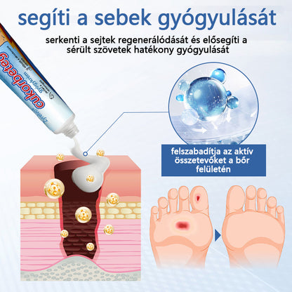 Zyrelvo®🎉VitaGluco cukorbetegség kezelésére szolgáló krém