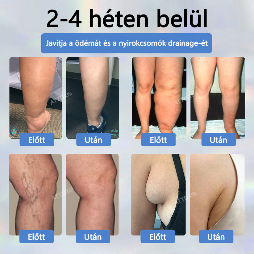 Cvreoz® Fekete kömény Ödéma méregtelenítő gyógynövénykrém🌿