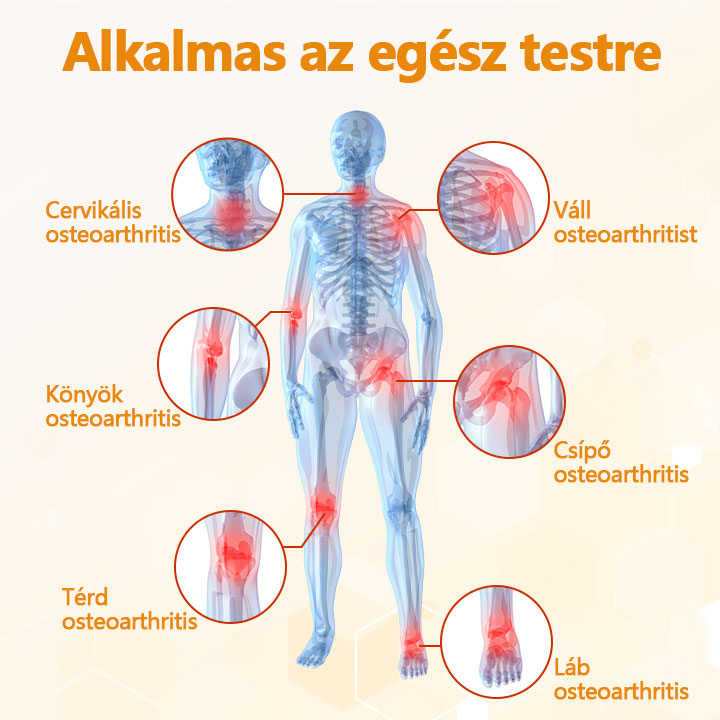 Biancat™ Méhméreg ízületjavító krém  – Természetes megoldás fájó ízületekre🌲