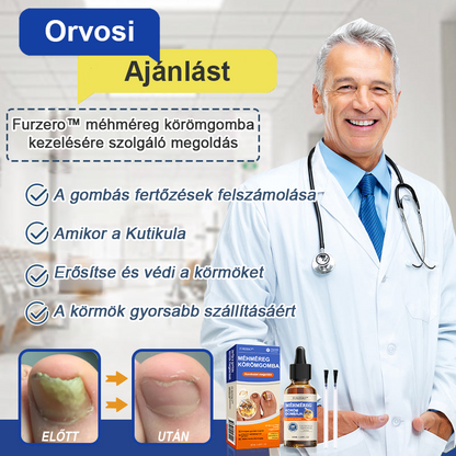🌟🌟Furzero™ méhméreg körömgomba kezelési megoldás:Teljesen megoldja a körömgomba problémát🐝🐝