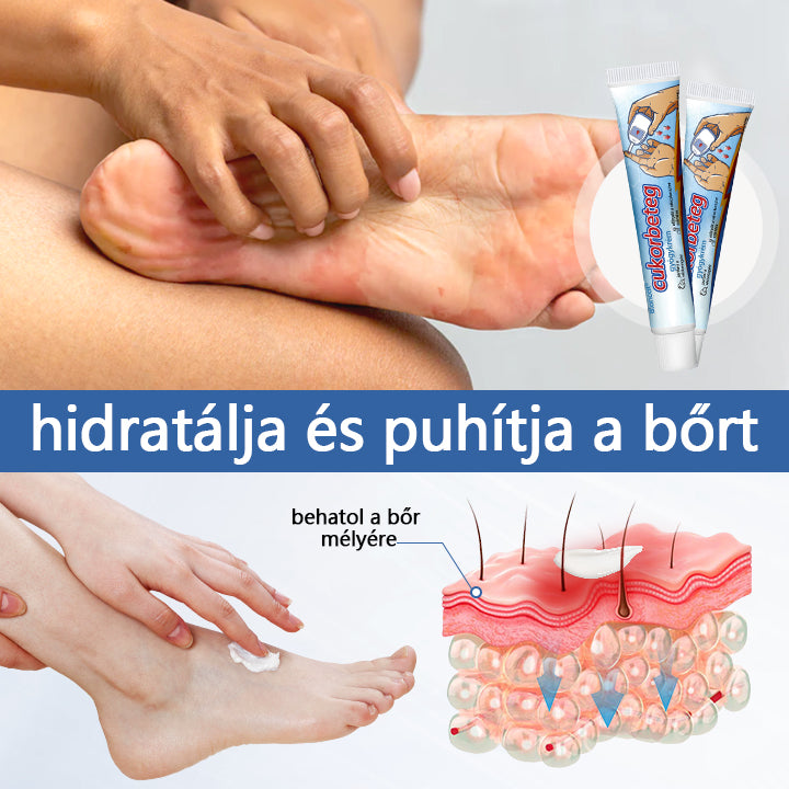 Biancat™ VitaGluco cukorbetegség kezelésére szolgáló krém