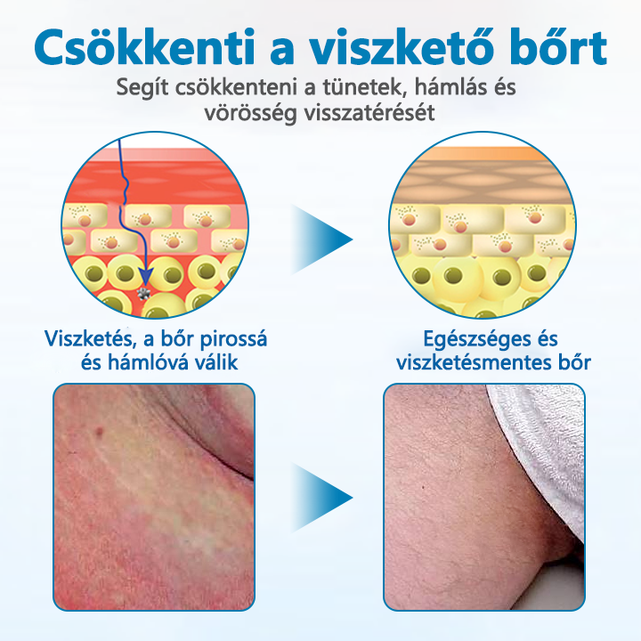 Timilk® Férfi GentX Relief Krém