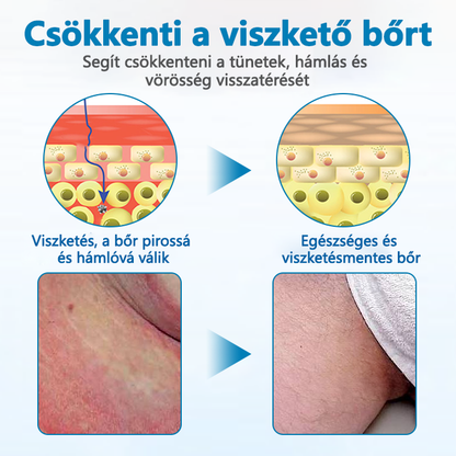 Timilk® Férfi GentX Relief Krém