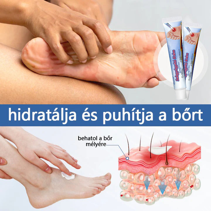 Biancat™ 🎉Sebgyógyító Krém✅