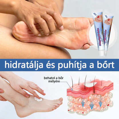 Biancat™ 🎉Sebgyógyító Krém✅