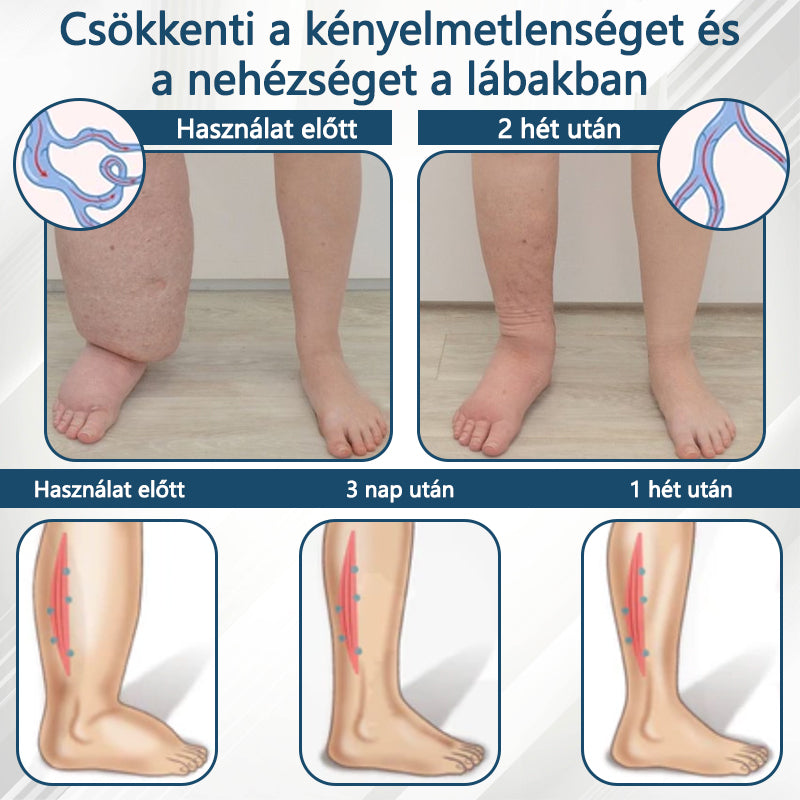 Cvreoz® Fekete kömény Ödéma méregtelenítő gyógynövénykrém🌿