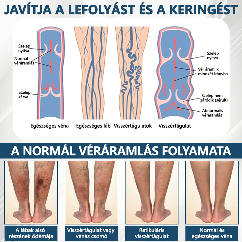 Cvreoz® Fekete kömény Ödéma méregtelenítő gyógynövénykrém🌿