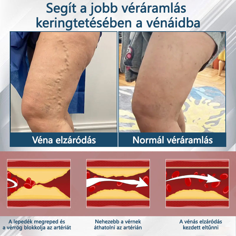 Cvreoz® Fekete kömény Ödéma méregtelenítő gyógynövénykrém🌿