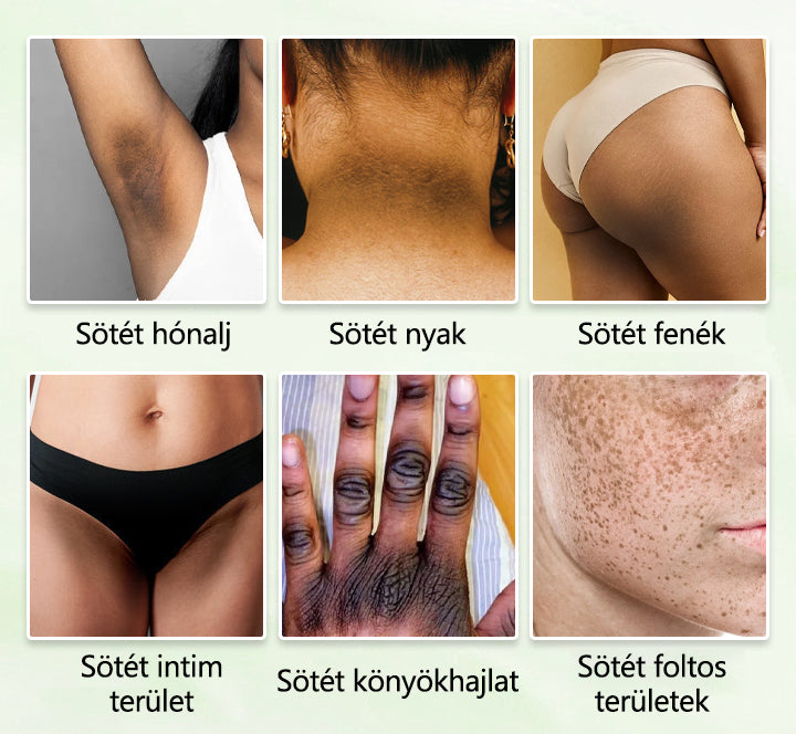 Biancat® GlowTrigger Intim Világosító Spray