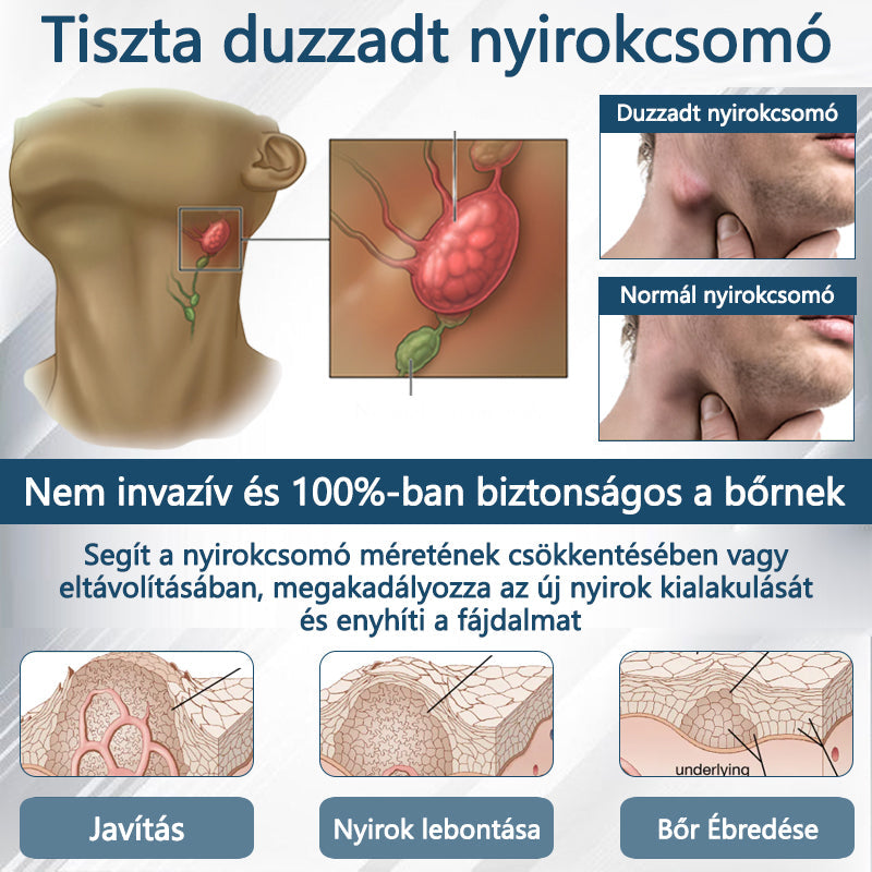 Cvreoz® Fekete kömény Ödéma méregtelenítő gyógynövénykrém🌿