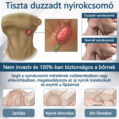 Cvreoz® Fekete kömény Ödéma méregtelenítő gyógynövénykrém🌿
