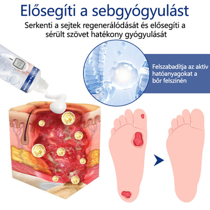 Timilk® SugarRelief diabéteszes kezelőkrém